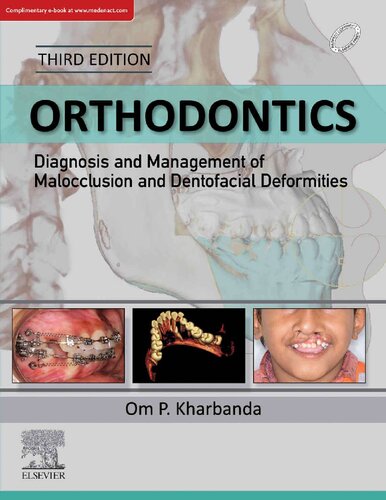 Orthodontics: Diagnosis and Management of Malocclusion and Dentofacial Deformities