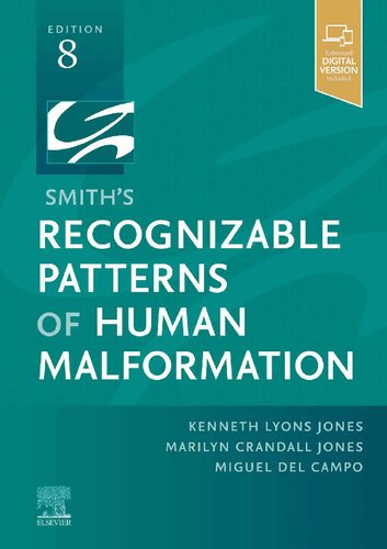Smith's Recognizable Patterns of Human Malformation: Expert Consult - Online and Print