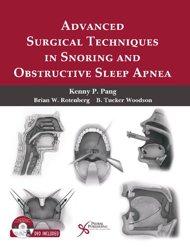 Advanced Surgical Techniques in Snoring and Obstructive Sleep Apnea