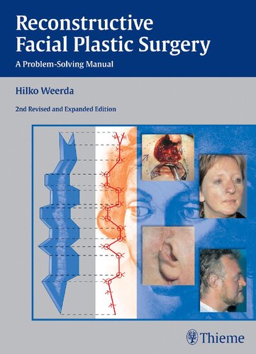 Reconstructive facial plastic surgery : A problem- solving manual.