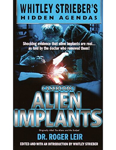 Casebook: Alien Implants (Whitley Streiber's Hidden Agendas)