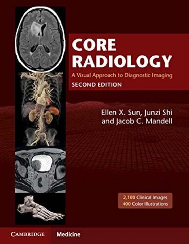 Core radiology : A Visual Approach To Diagnostic Imaging