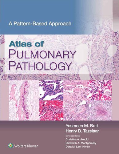 Atlas of Pulmonary Pathology: A Pattern Based Approach