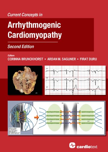 Current Concepts in Arrhythmogenic Cardiomyopathy, Second Edition
