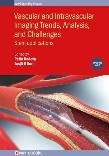 Vascular and Intravascular Imaging Trends, Analysis, and Challenges: Stent Applications