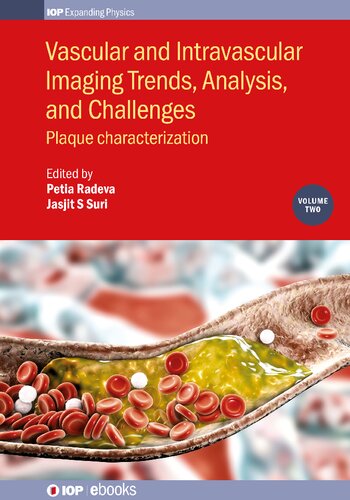 Vascular and Intravalcular Imaging Trends, Analysis, and Challenges: Plaque Characterization