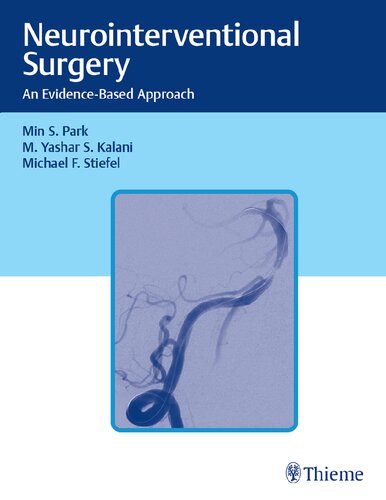 Neurointerventional Surgery: An Evidence-Based Approach