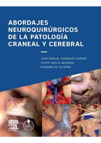 Abordajes neuroquirúrgicos de la patología craneal y cerebral + acceso web