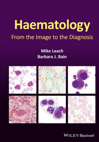 Haematology: From the Image to the Diagnosis