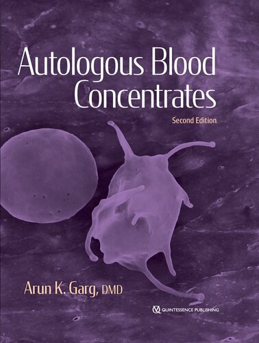 Autulogous Blood Concentrates