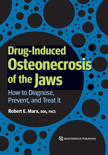 Drug-Induced Osteonecrosis of the Jaws: How to Diagnose, Prevent, and Treat It