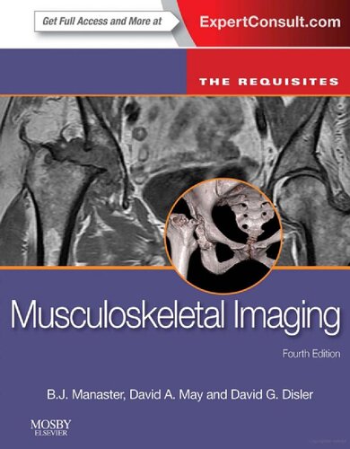 Musculoskeletal imaging : the requisites