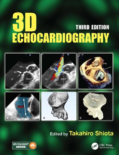 3D Echocardiography