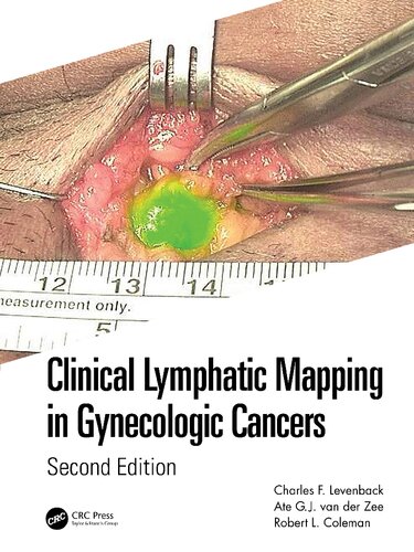 CLINICAL LYMPHATIC MAPPING IN GYNECOLOGIC CANCERS