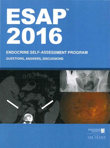 ESAP™ 2016 Endocrine Self-Assessment Program Questions&Answers Discussions Endocrine Society