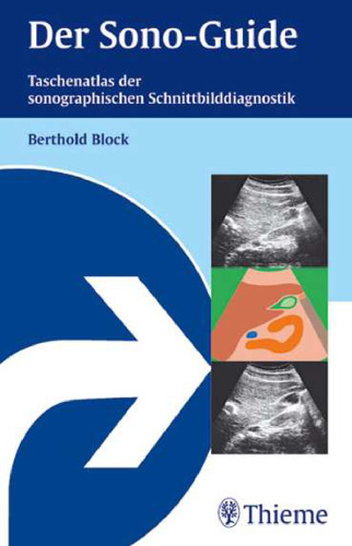 Der Sono-Guide. Taschenatlas der sonographischen Schnittbilddiagnostik.