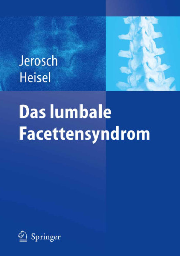 Das lumbale Facettensyndrom 