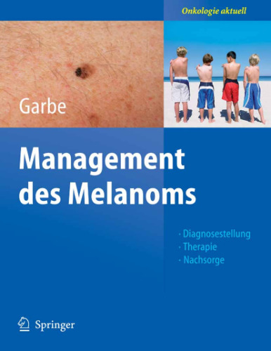 Management des Melanoms (Onkologie aktuell) 