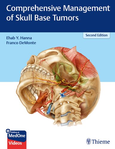 Comprehensive management of skull base tumors