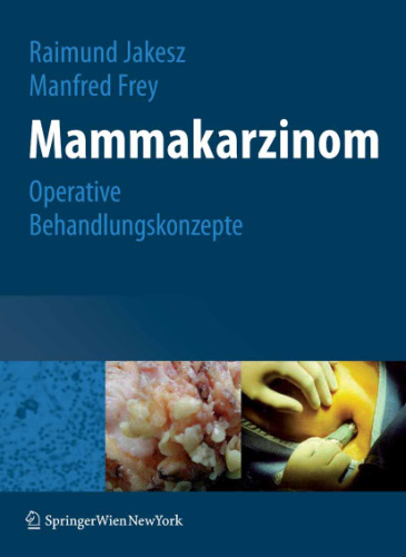 Mammakarzinom: Operative Behandlungskonzepte