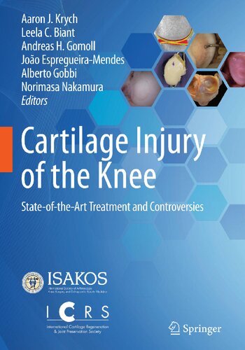 Cartilage Injury of the Knee
