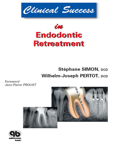 Endodontic Retreatment
