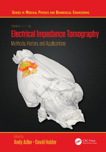 Electrical impedance tomography : methods, history and applications