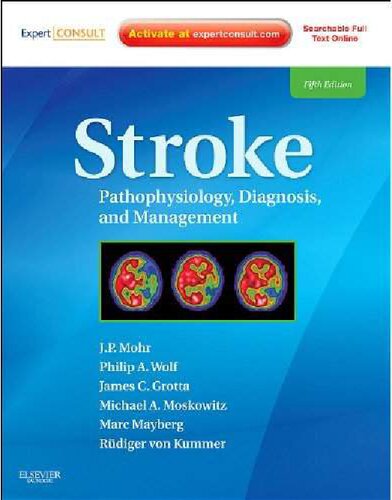 Stroke: Pathophysiology, Diagnosis, and Management, 5th Edition J. P. Mohr MS MD