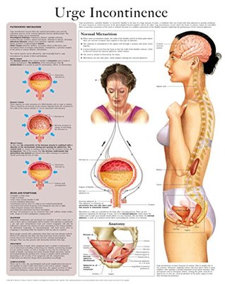 Urge Incontinence e-chart: Full illustrated