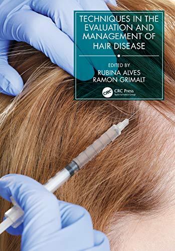 Techniques in the Evaluation and Management of Hair Diseases (Series in Dermatological Treatment)