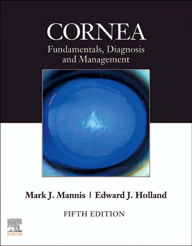 Cornea: Fundamentals, Diagnosis and Management
