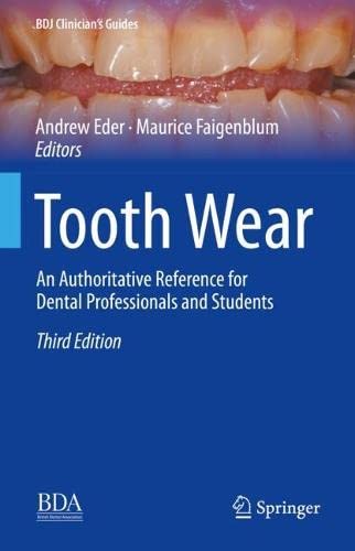 Tooth Wear: An Authoritative Reference for Dental Professionals and Students (BDJ Clinician’s Guides)