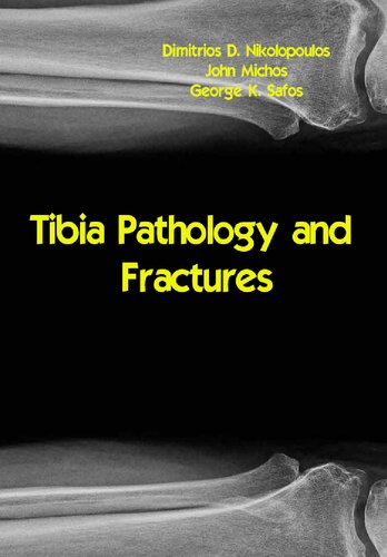 Tibia pathology and fractures