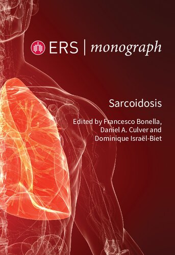 Sarcoidosis