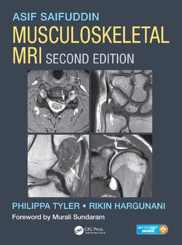 Musculoskeletal MRI : a rapid reference guide