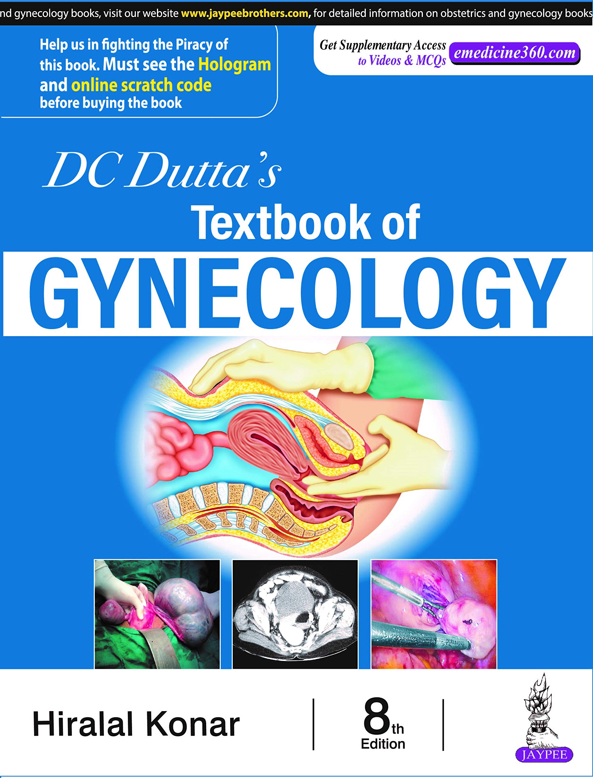 DC Dutta's Textbook of Gynecology