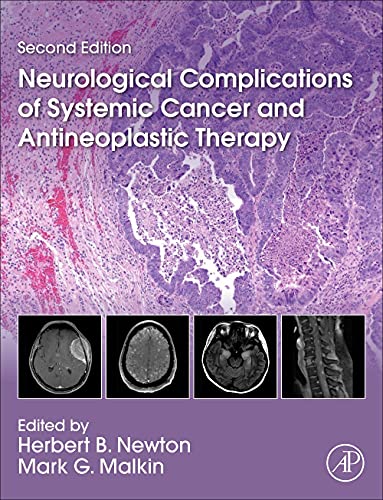 Neurological Complications of Systemic Cancer and Antineoplastic Therapy