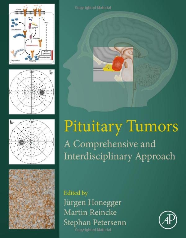 Pituitary Tumors: A Comprehensive and Interdisciplinary Approach
