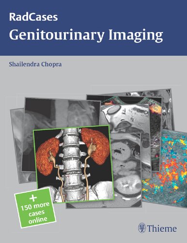 Radcases Genitourinary Imaging (Radcases Plus Q&A)