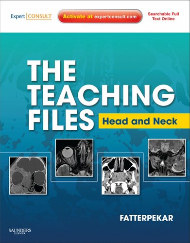 The Teaching Files: Head and Neck Imaging: Expert Consult - Online and Print (Teaching Files in Radiology)