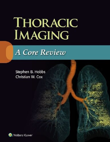Thoracic Radiology: A Core Review