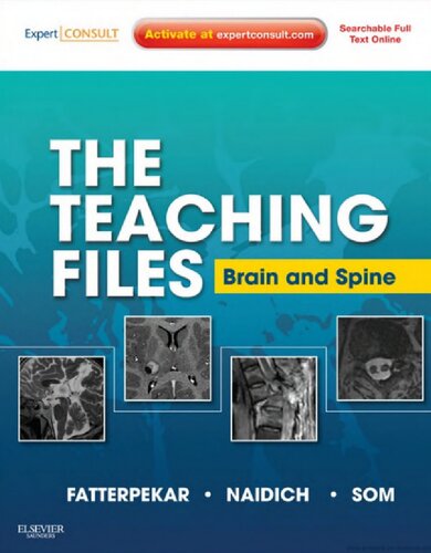 The Teaching Files: Brain and Spine: Expert Consult - Online and Print