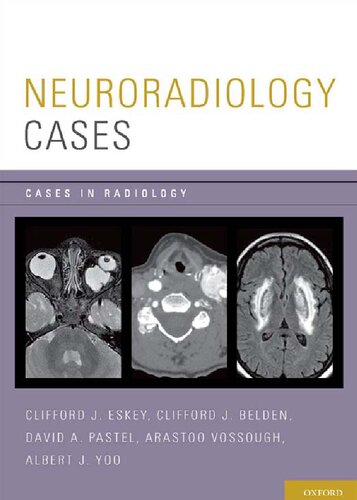 Neuroradiology Cases (Cases in Radiology)