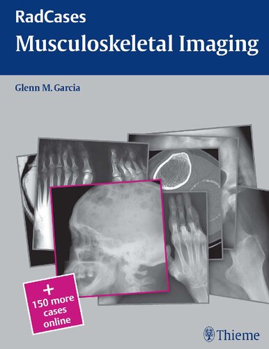 Radcases Musculoskeletal Radiology (Radcases Plus Q&A)