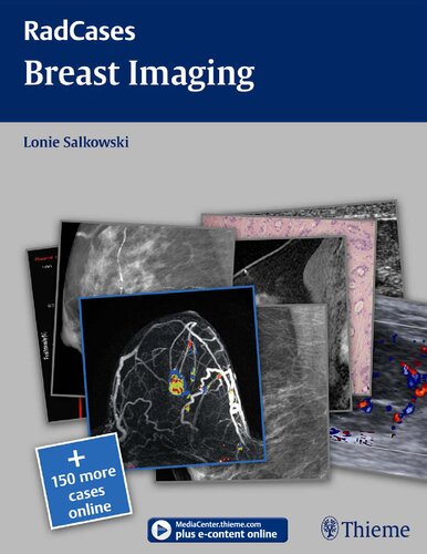 Radcases Breast Imaging (Radcases Plus Q&A)