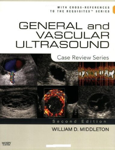 General and Vascular Ultrasound: Case Review Series
