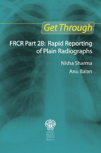 Get through FRCR part 2B : rapid reporting of plain radiographs