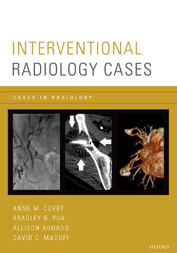 Interventional Radiology Cases (Cases in Radiology)