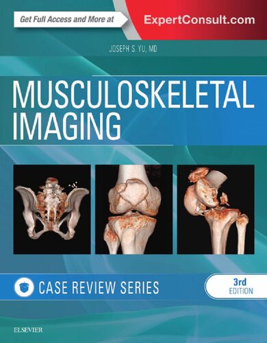 Musculoskeletal Imaging: Case Review Series