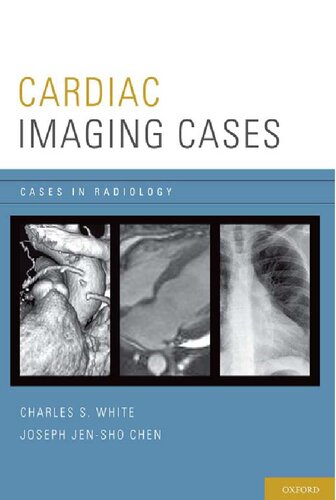 Cardiac Imaging Cases (Cases in Radiology)